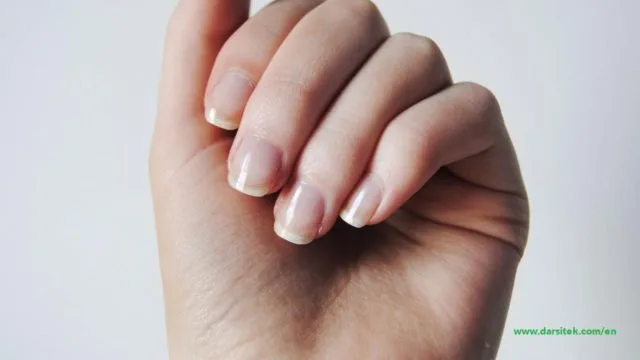 nail condition nail condition
