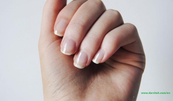 nail condition