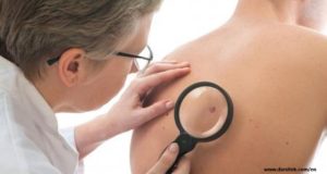 signs of skin cancer