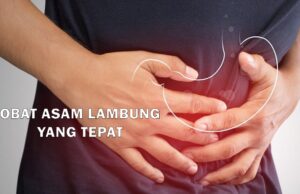 obat asam lambung